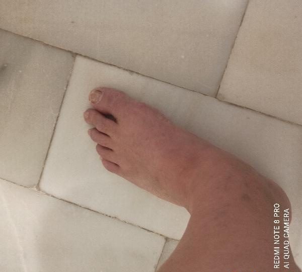 DEPILACIÓN CON CREMA SIN DOLOR EN EL PUERTO DE SANTA MARÍA